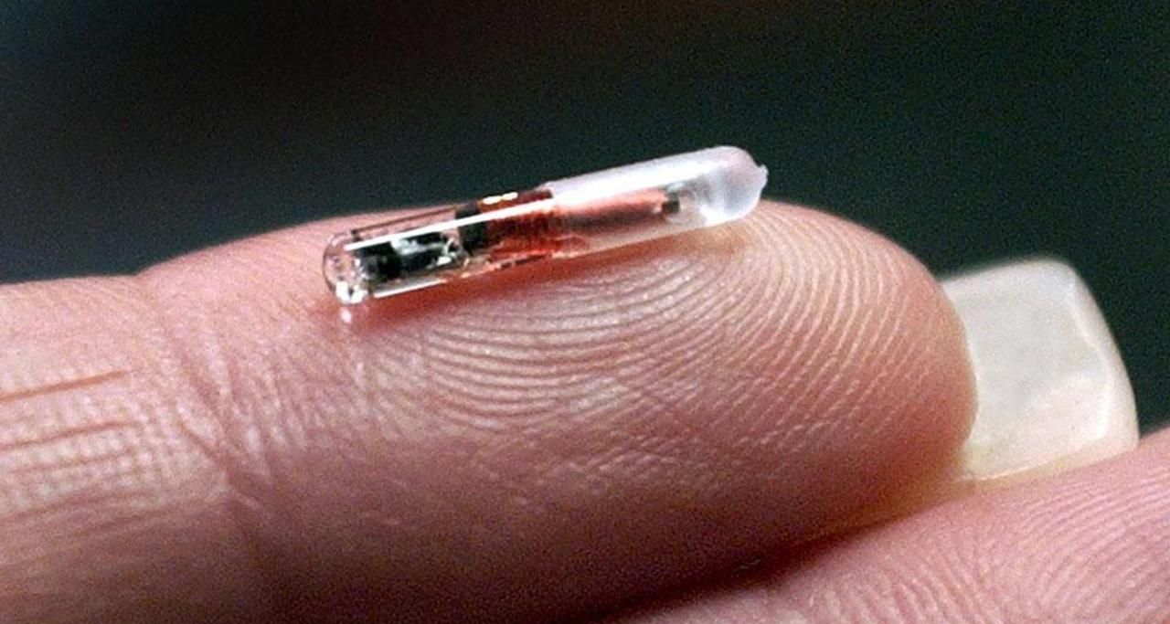 RFID microchip implants - 1