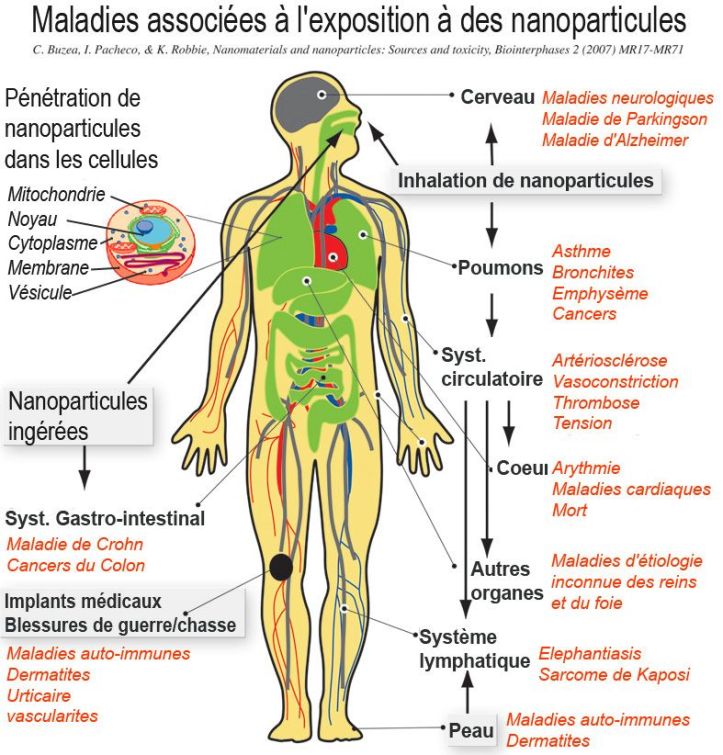 Maladies associées à l_exposition des nanoparticules