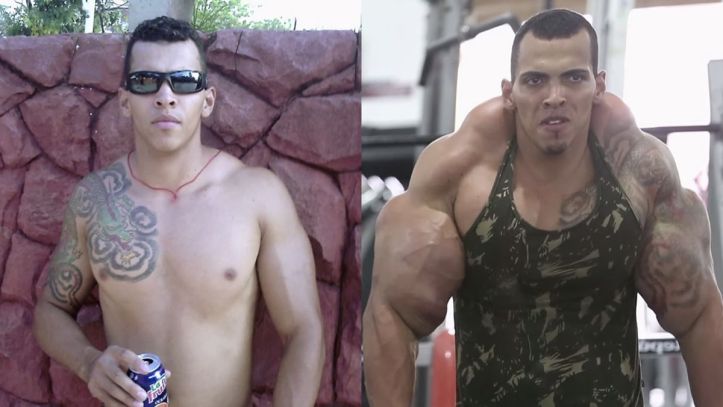 Synthol – Muscle - 2